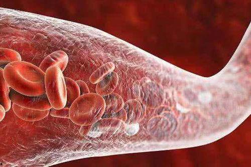 血液淤堵可以吃猪瓜吗,缓解血液淤堵困扰  第2张